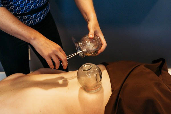 Cupping Therapy 3